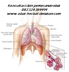obat batuk paru,obat paru paru basah,obat batuk menahun,obat batuk TBC,obat batuk akibat rokok,obat batuk paru paru,obat paru paru bocor,obat batuk berlendir,obat batuk berdarah